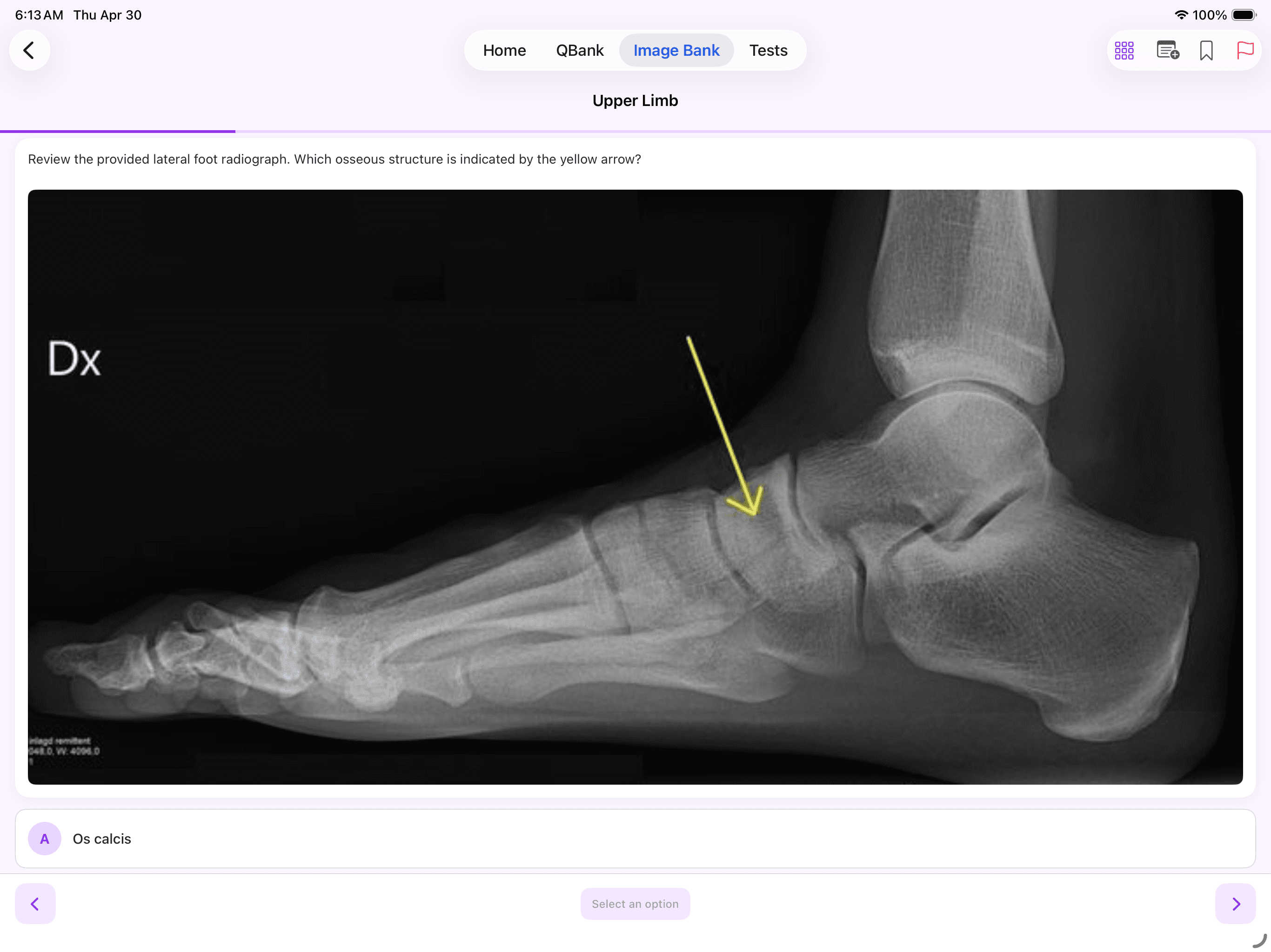 Kinase Image Bank — clinical X-ray with worked answer